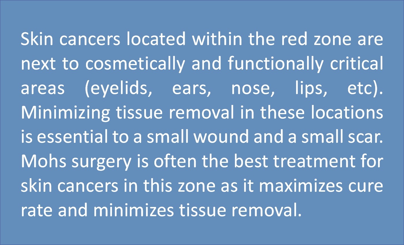 legend-T-zone_LARGE Mohs Micrographic Surgery Houston Dermatologist