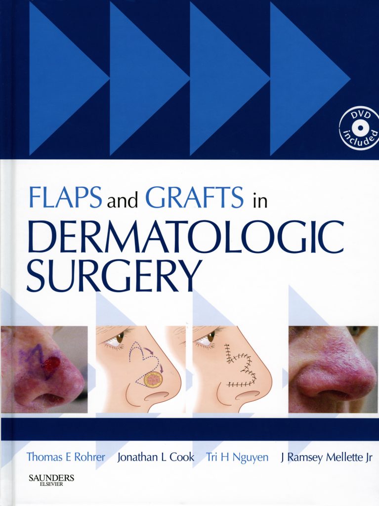 Surgical & Cosmetic Dermatology | Skin flap alternatives for🦠 Descubra ...