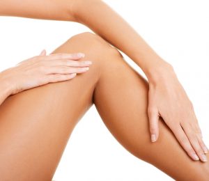 Patient-treated-for-varicose-veins-and-spider-veins-300x260 Varicose Vein Treatment Procedure Steps Houston Dermatologist