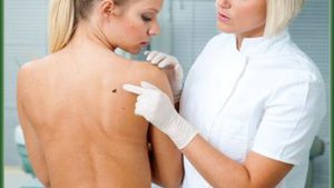 skin-cancer-treatments-the-woodlands-texas-300x169 How Long Will My Mohs Surgery Recovery Be? Houston Dermatologist