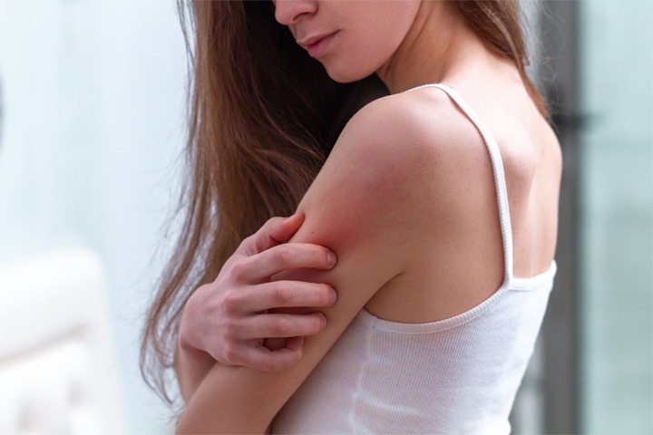 arm-itch Houston Dermatologist FAQ: Ways to Get Relief From Chronic Hives Houston Dermatologist